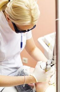 Ένας γιατρός εκτελεί μια διαδικασία φωτοθερμόλυσης