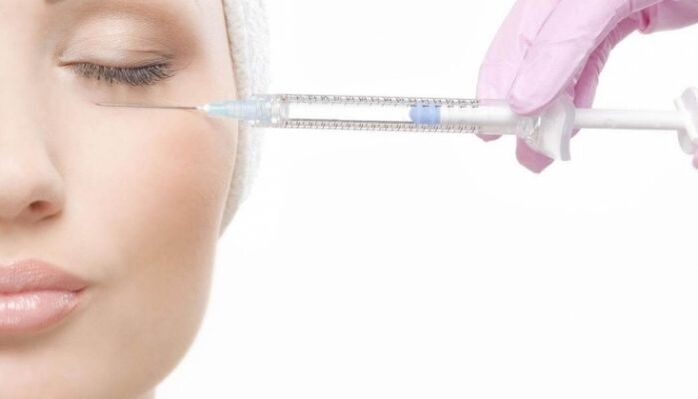 Ανύψωση πλάσματος