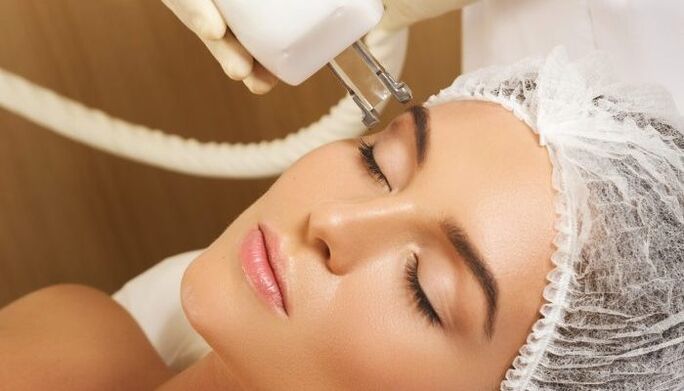 Θερμολίφτινγκ