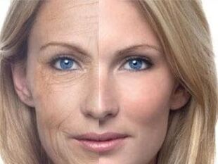 Μελάγχρωση του δέρματος