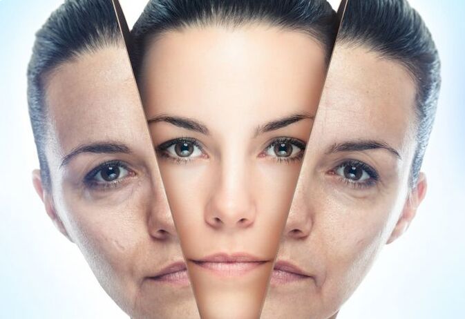 Η διαδικασία εξάλειψης των αλλαγών που σχετίζονται με την ηλικία στο δέρμα του προσώπου